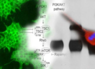 Auf dem Weg zur individuellen Medizin